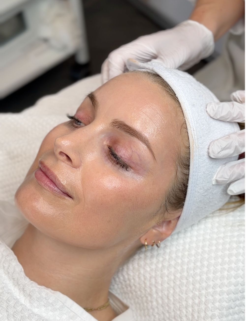 PDRN Glow Skinbooster-behandling hos Fr&oslash;yd
