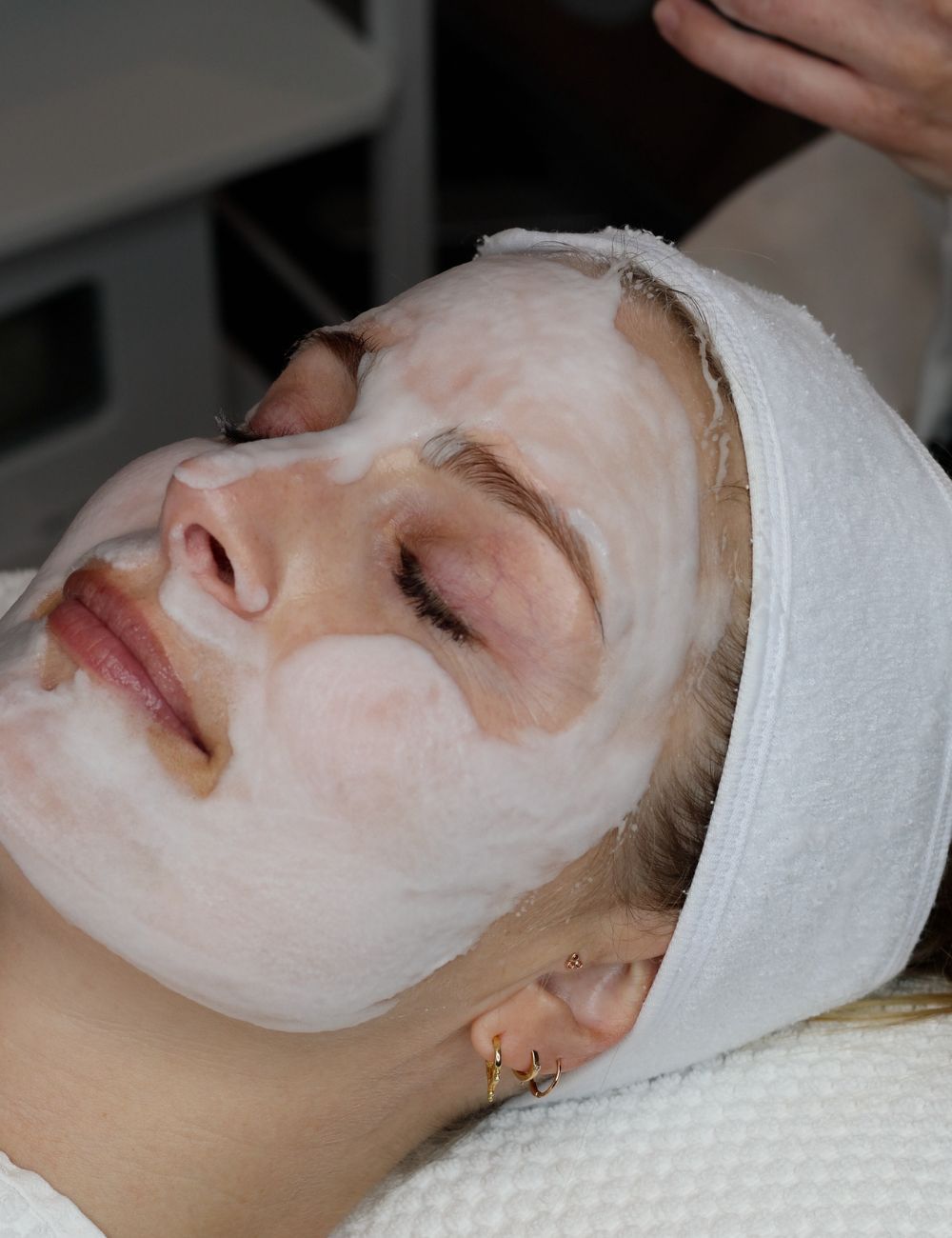 Mild peeling hos Fr&oslash;yd